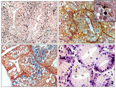 The Role of the Cephalopod Digestive Gland in the Storage and Detoxification of Marine Pollutants